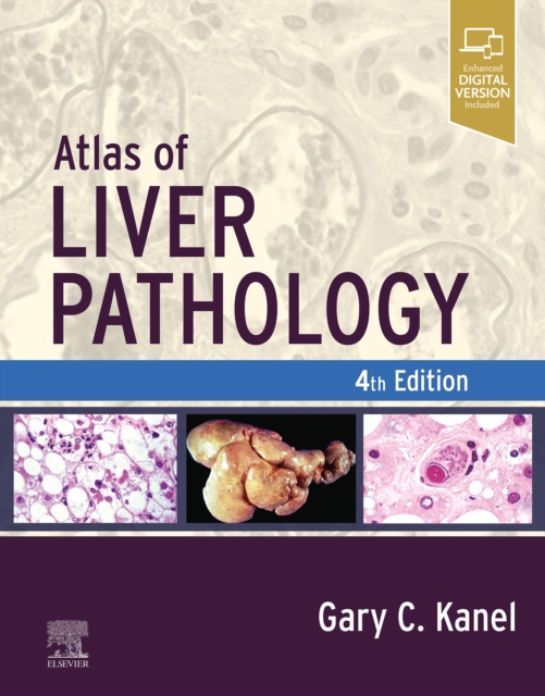 Atlas of Liver Pathology - E-Book, EPUB eBook