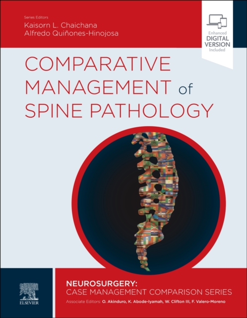 Comparative Management of Spine Pathology, Hardback Book