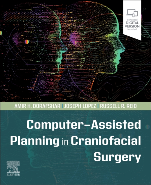 Computer-Assisted Planning in Craniofacial Surgery, Paperback / softback Book