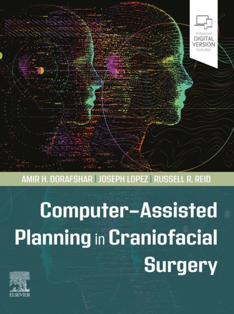 Computer-Assisted Planning in Craniofacial Surgery - E-Book, EPUB eBook