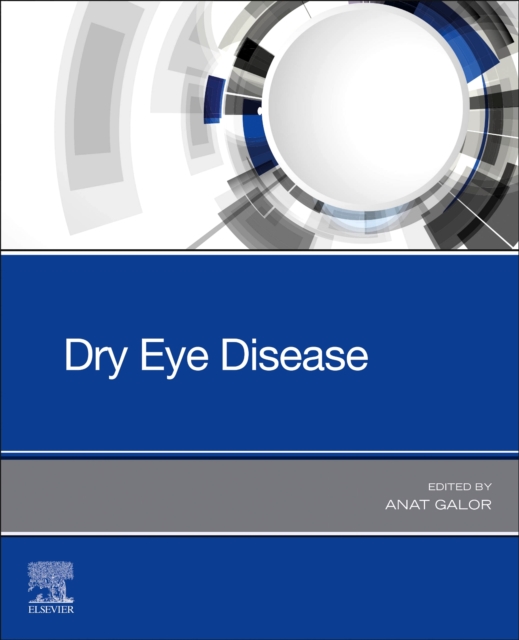 Dry Eye Disease, Paperback / softback Book
