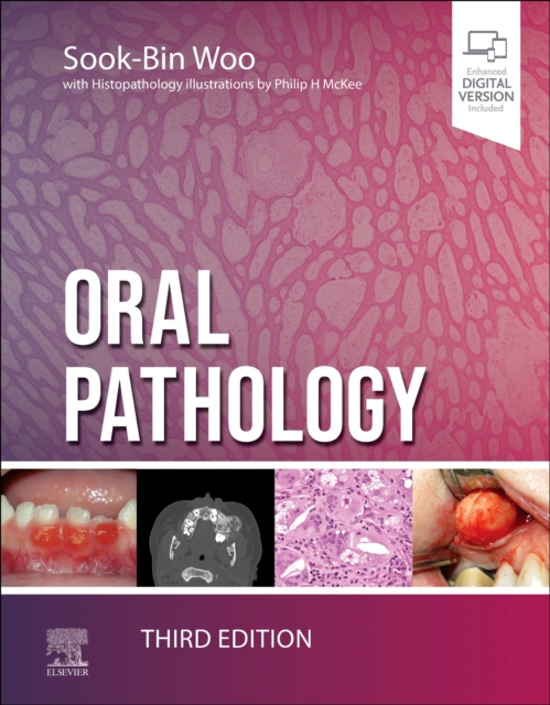 Oral Pathology, Hardback Book