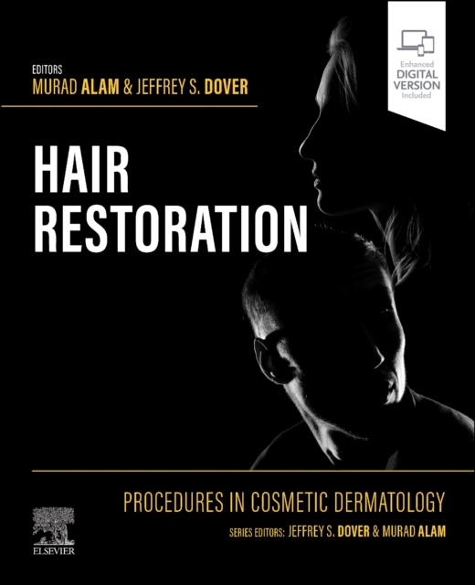 Procedures in Cosmetic Dermatology: Hair Restoration, Hardback Book