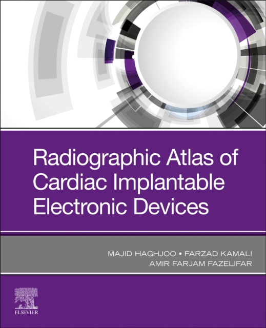 Radiographic Atlas of Cardiac Implantable Electronic Devices, Paperback / softback Book