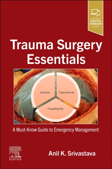 Trauma Surgery Essentials : A Must-Know Guide to Emergency Management, Paperback / softback Book