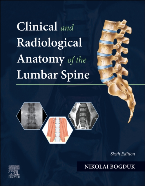 Clinical and Radiological Anatomy of the Lumbar Spine, Paperback / softback Book