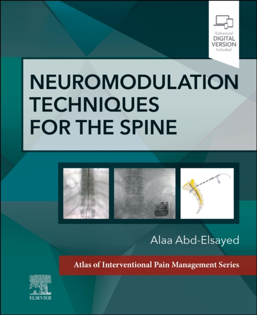 Neuromodulation Techniques for the Spine : A Volume in the Atlas of Interventional Pain Management Series, Hardback Book