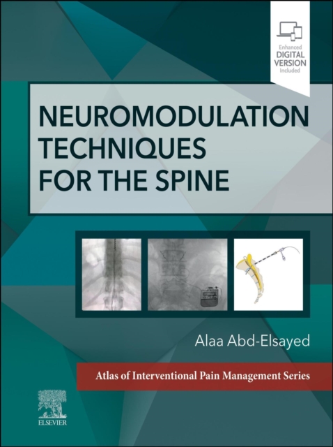 Neuromodulation Techniques for the Spine : A Volume in the Atlas of Interventional Pain Management Series, EPUB eBook