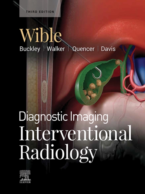 Diagnostic Imaging: Interventional Radiology : Diagnostic Imaging: Interventional Radiology E-Book, EPUB eBook