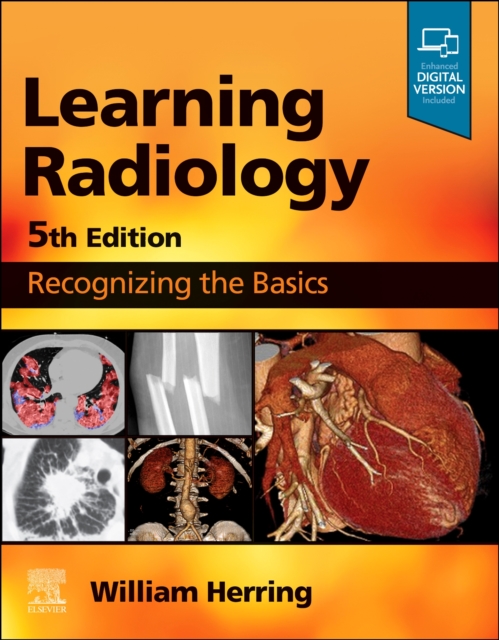 Learning Radiology : Recognizing the Basics, Paperback / softback Book