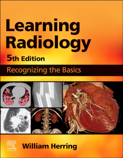 Learning Radiology E-Book : Learning Radiology E-Book, EPUB eBook