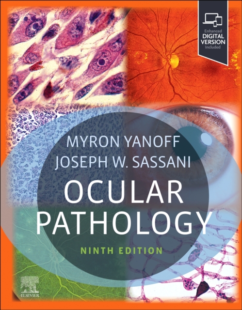 Ocular Pathology, Hardback Book