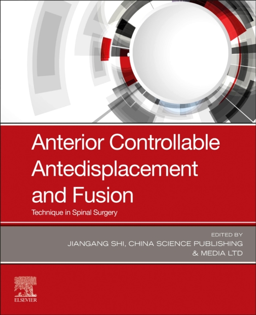 Anterior Controllable Antedisplacement and Fusion : Technique in Spinal Surgery, Paperback / softback Book