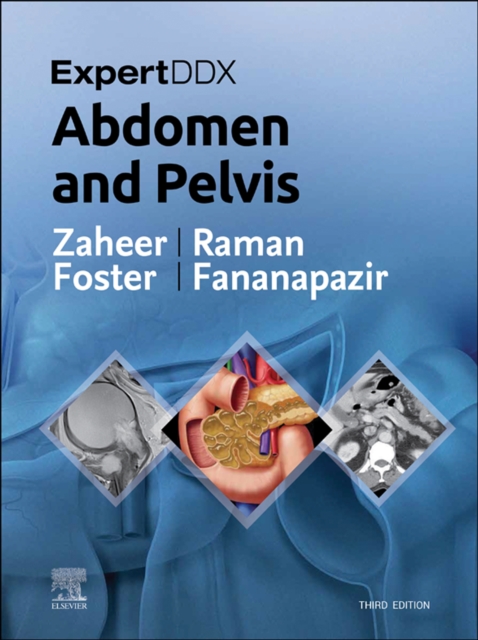 ExpertDDx: Abdomen and Pelvis E-Book : ExpertDDx: Abdomen and Pelvis E-Book, EPUB eBook