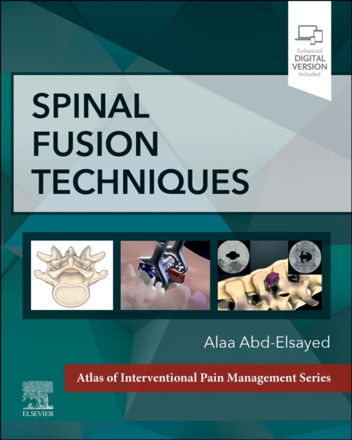 Spinal Fusion Techniques, Hardback Book