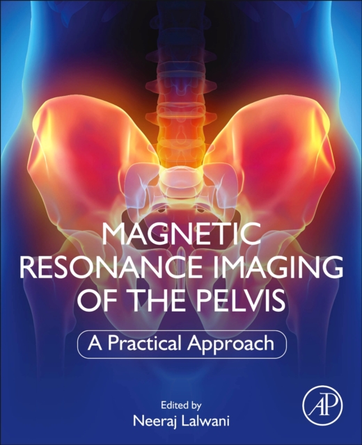 Magnetic Resonance Imaging of The Pelvis : A Practical Approach, Paperback / softback Book