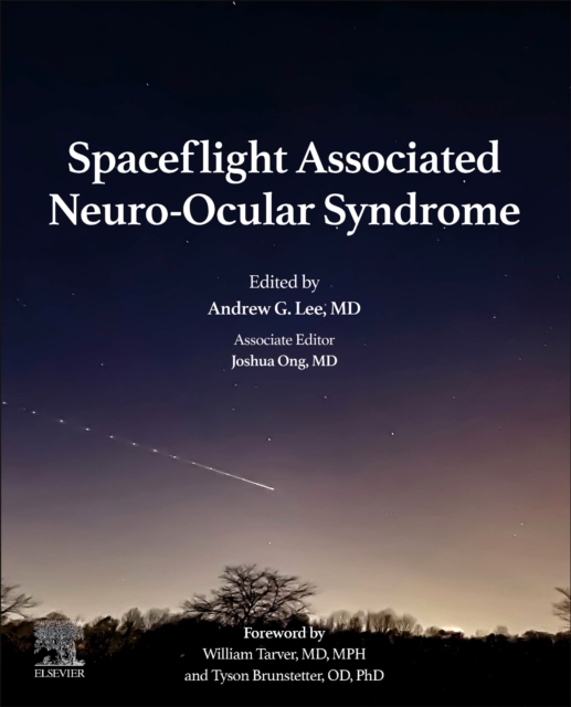 Spaceflight Associated Neuro-Ocular Syndrome, Paperback / softback Book