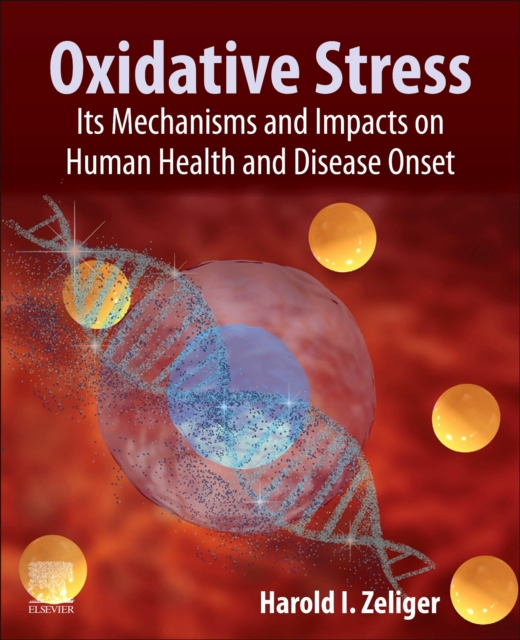 Oxidative Stress : Its Mechanisms and Impacts on Human Health and Disease Onset, Paperback / softback Book