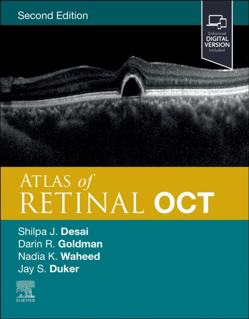 Atlas of Retinal OCT : Optical Coherence Tomography, Hardback Book