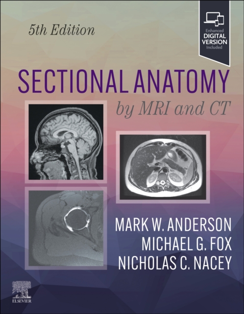 Sectional Anatomy by MRI and CT, Hardback Book