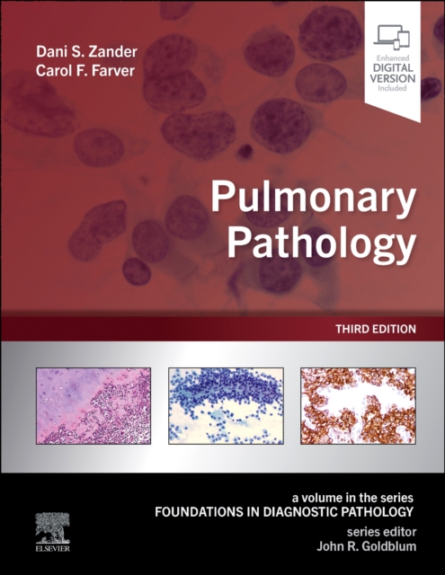 Pulmonary Pathology, Hardback Book