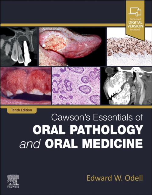 Cawson's Essentials of Oral Pathology and Oral Medicine, Paperback / softback Book