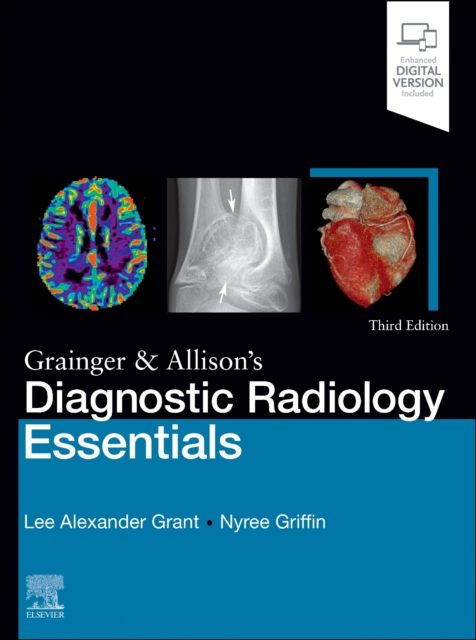 Grainger & Allison's Diagnostic Radiology Essentials, Hardback Book