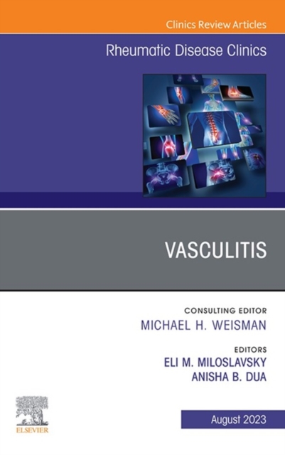 Vasculitis, An Issue of Rheumatic Disease Clinics of North America, E-Book : Vasculitis, An Issue of Rheumatic Disease Clinics of North America, E-Book, EPUB eBook