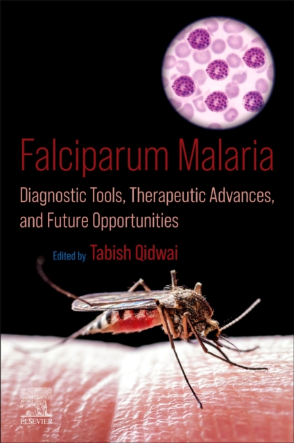Falciparum Malaria : Diagnostic Tools, Therapeutic Advances, and Future Opportunities, Paperback / softback Book