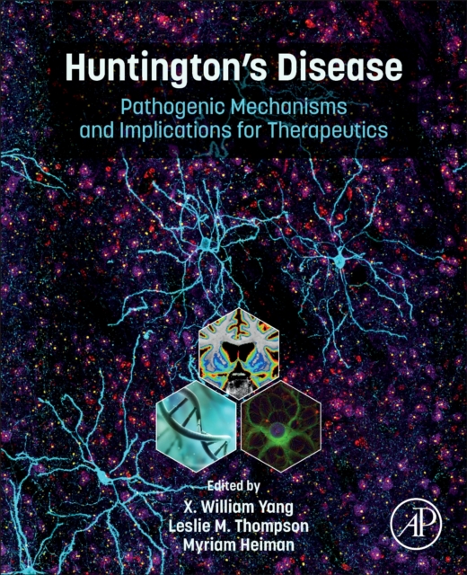 Huntington’s Disease : Pathogenic Mechanisms and Implications for Therapeutics, Paperback / softback Book