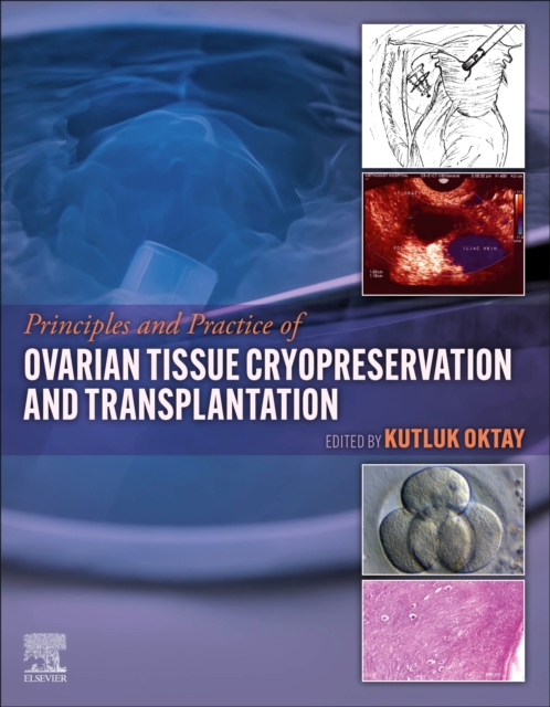 Principles and Practice of Ovarian Tissue Cryopreservation and Transplantation, Hardback Book