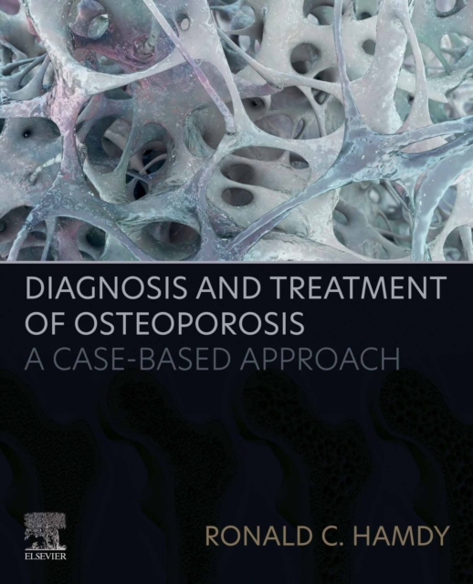 Diagnosis and Treatment of Osteoporosis : A Case-Based Approach, EPUB eBook