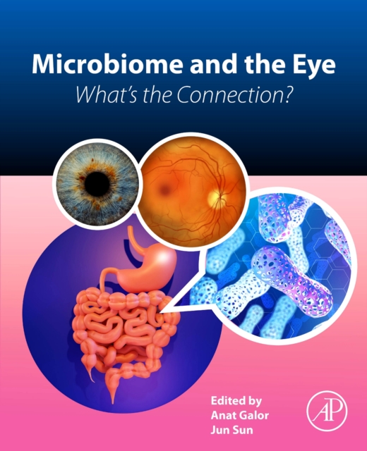 Microbiome and the Eye : What's the Connection?, Paperback / softback Book