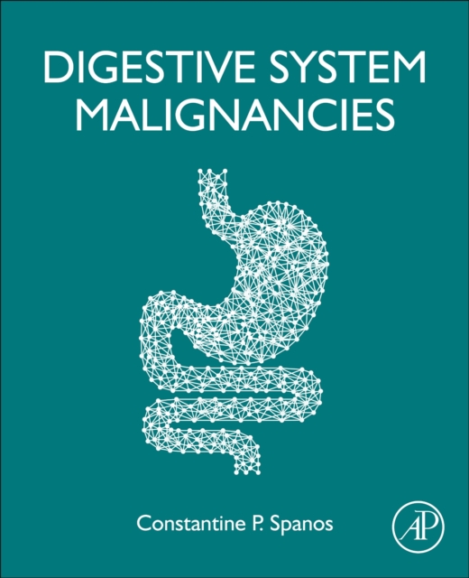 Digestive System Malignancies, Paperback / softback Book
