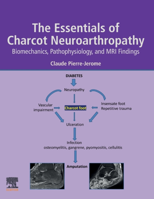 The Essentials of Charcot Neuroarthropathy : Biomechanics, Pathophysiology, and MRI Findings, Paperback / softback Book
