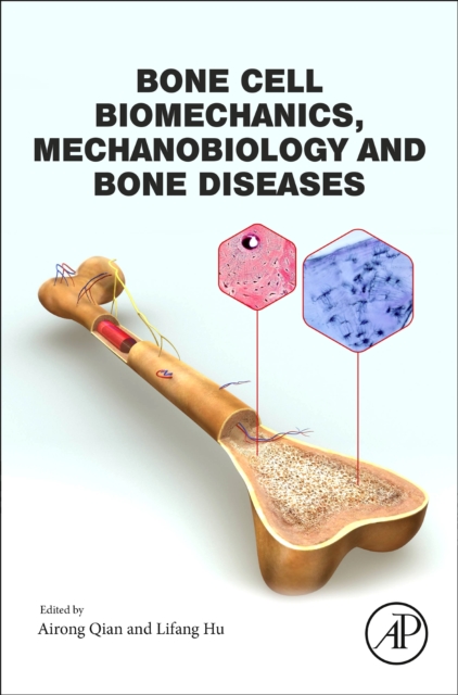Bone Cell Biomechanics, Mechanobiology and Bone Diseases, EPUB eBook