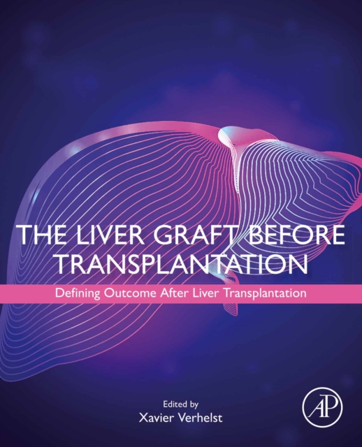 The Liver Graft Before Transplantation : Defining Outcome After Liver Transplantation, EPUB eBook