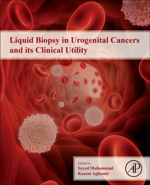 Liquid Biopsy in Urogenital Cancers and its Clinical Utility, Paperback / softback Book
