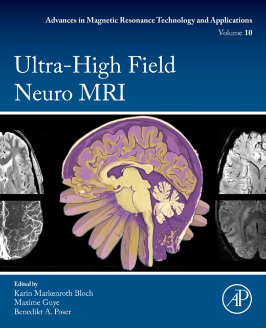 Ultra-High Field Neuro MRI : Volume 10, Paperback / softback Book