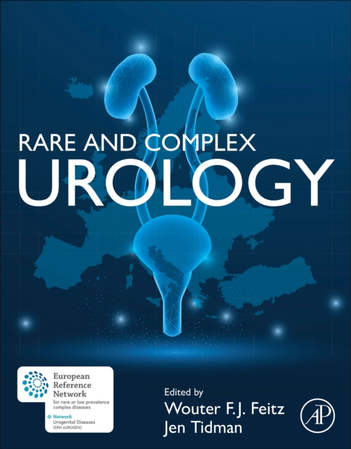 Rare and Complex Urology, Paperback / softback Book
