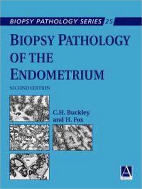 Biopsy Pathology of the Endometrium, 2Ed, Hardback Book