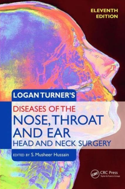 Logan Turner's Diseases of the Nose, Throat and Ear, Head and Neck Surgery, Paperback / softback Book