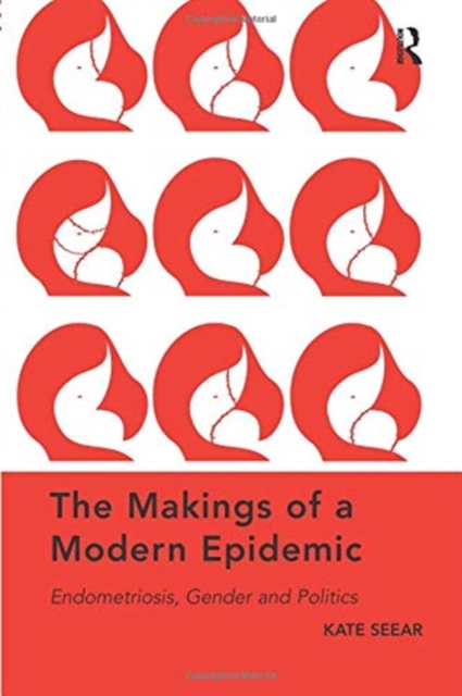 The Makings of a Modern Epidemic : Endometriosis, Gender and Politics, Paperback / softback Book