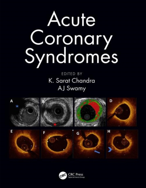 Acute Coronary Syndromes, Paperback / softback Book
