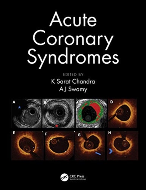 Acute Coronary Syndromes, Hardback Book