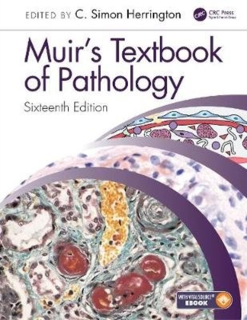 Muir's Textbook of Pathology : Sixteenth Edition International Student Edition, Hardback Book