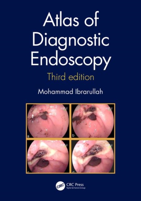 Atlas of Diagnostic Endoscopy, 3E, Hardback Book