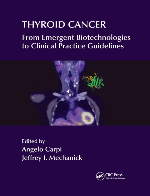 Thyroid Cancer : From Emergent Biotechnologies to Clinical Practice Guidelines, Paperback / softback Book