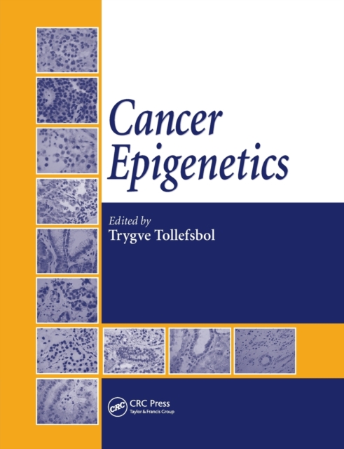 Cancer Epigenetics, Paperback / softback Book
