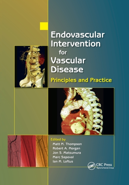 Endovascular Intervention for Vascular Disease : Principles and Practice, Paperback / softback Book